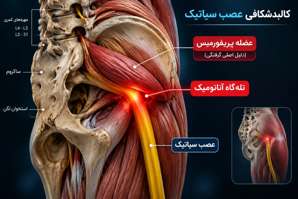 عصب سیاتیک